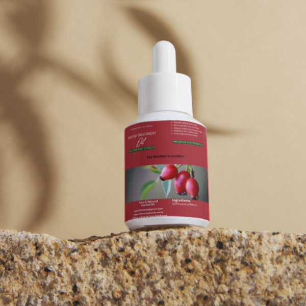 Rosemary Mint Oil with Biotin | Hair Growth & Anti Hair Fall – 30 ml